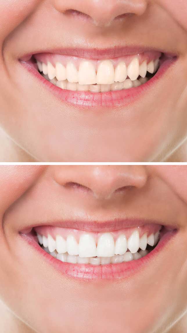 best-dentist-in-bromley-near-me