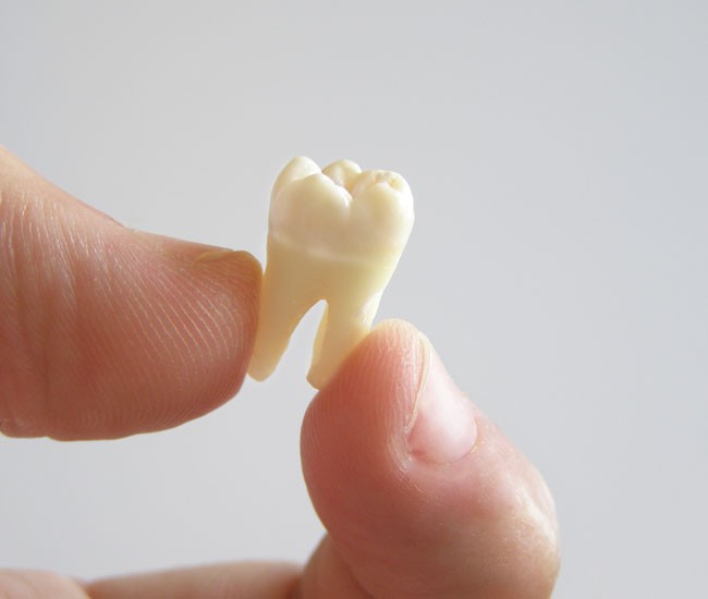 Voorhees  NJ Dentist who pull teeth