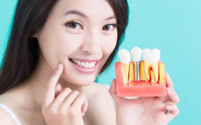 Why Replacing Missing Teeth Is Good For Oral Health