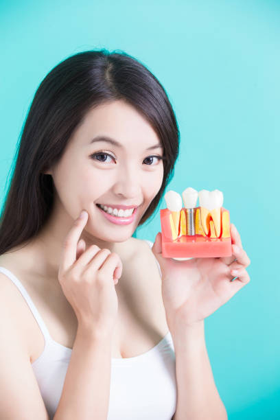 Why Replacing Missing Teeth Is Good For Oral Health