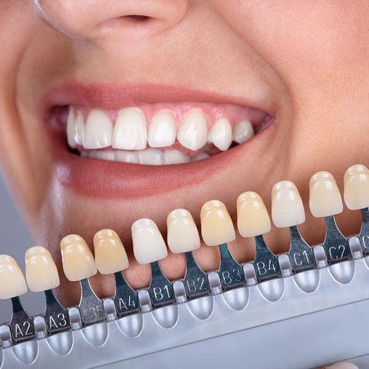 cheap-dental-implants-near-me