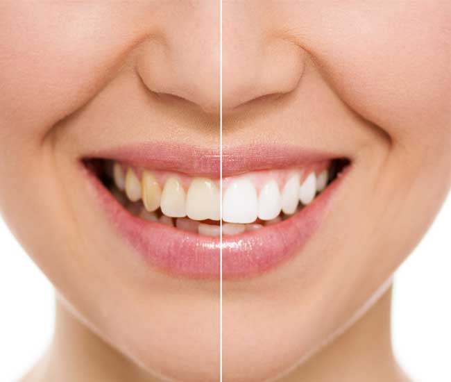 vorhees-new-jersey-dentist-near-me