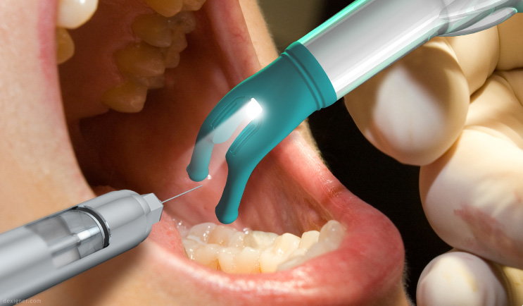 How Dangerous are Dental X-Rays?