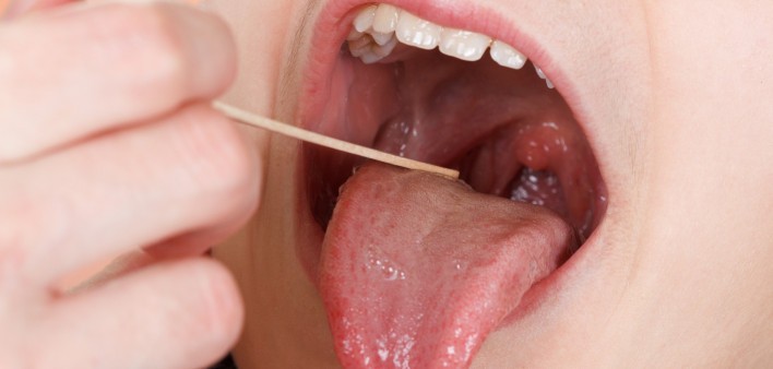 Risk Factors of Oral Cancer